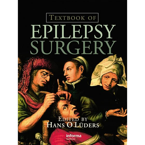 Amazon.com: Epilepsy: A Comprehensive Textbook eBook : Engel, Jr